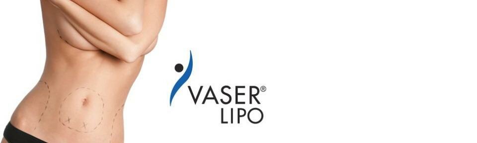 Vaser Liposuction - Simple ultrasound Liposuction